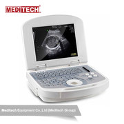 High quality hospital portable ultrasound scanner with CE certificatio